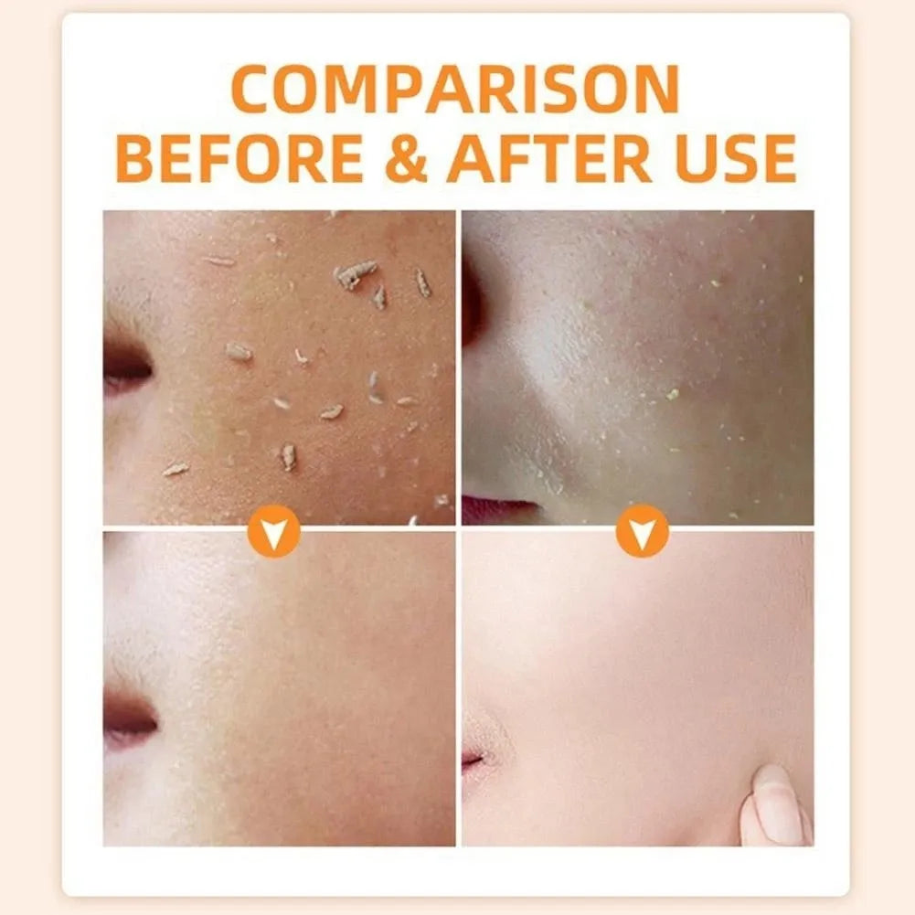 POUQUR Dead Skin Removal Face Wash Gel